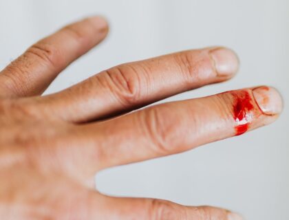 rachel cut herself and is bleeding heavily. how should she responsibly handle her injury?